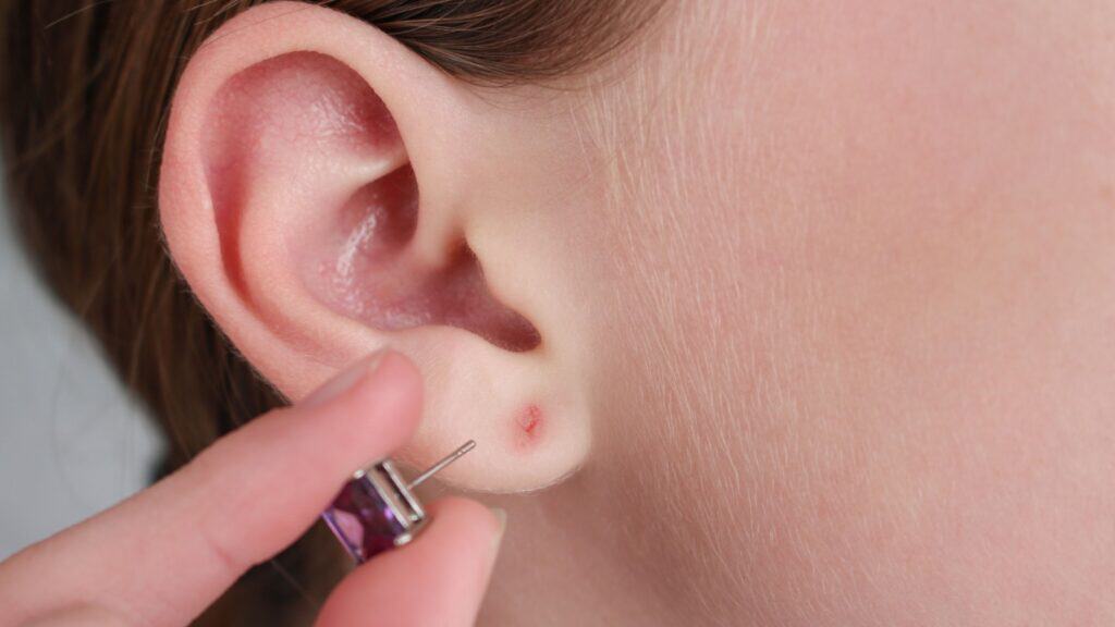 Earring. Ear irritation. 