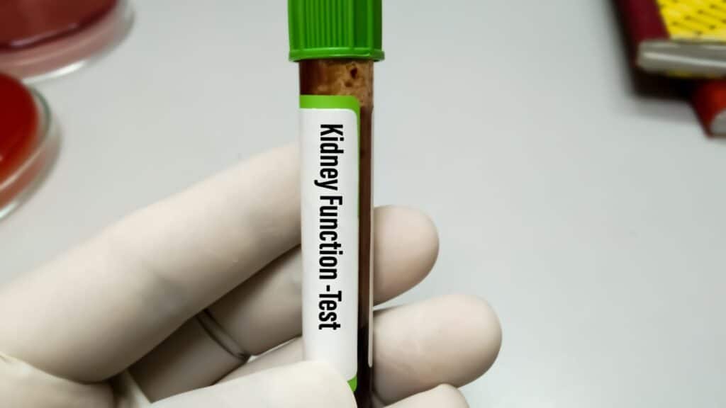 Kidney function test. 