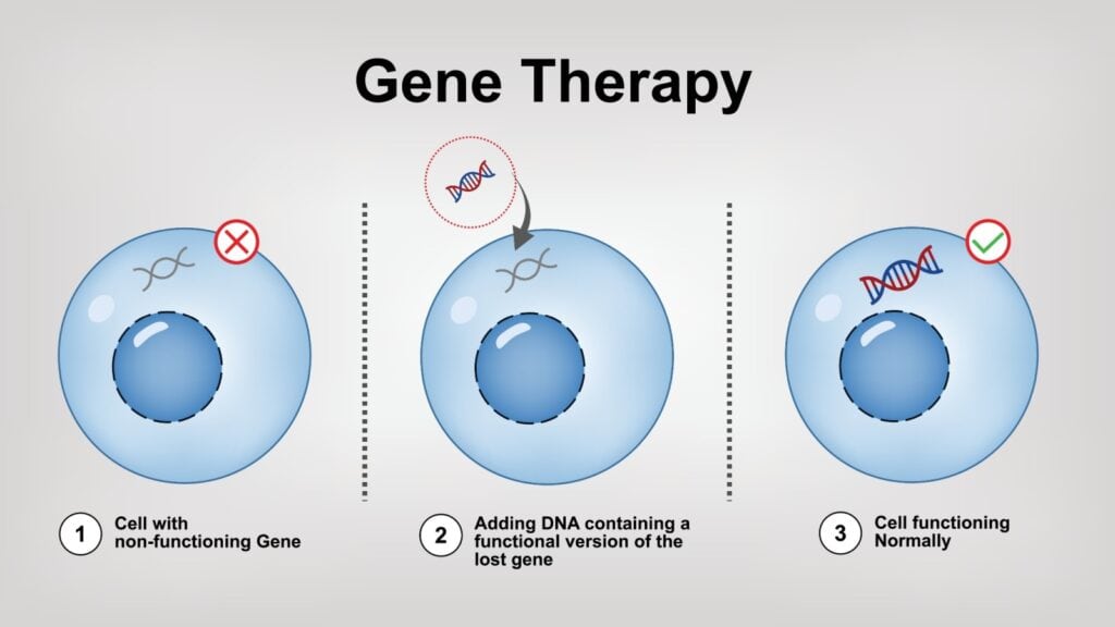 Gene therapy.