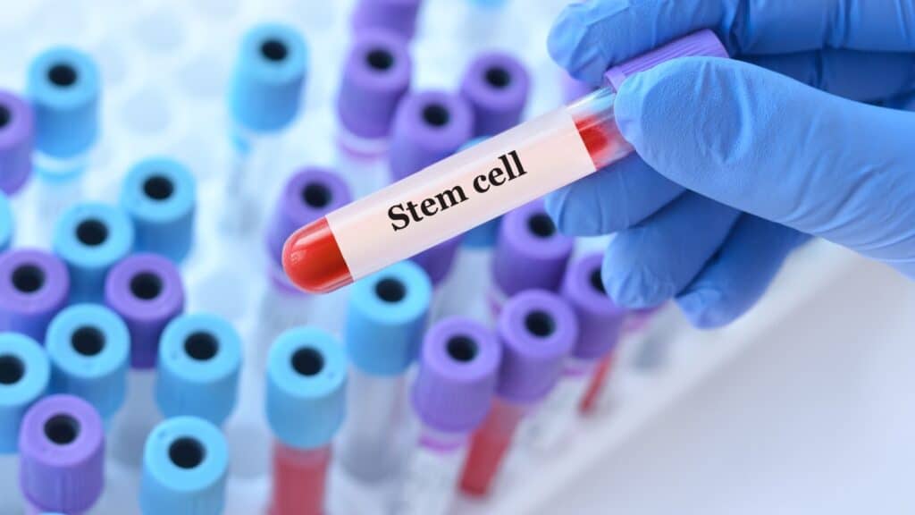 Stem cells.