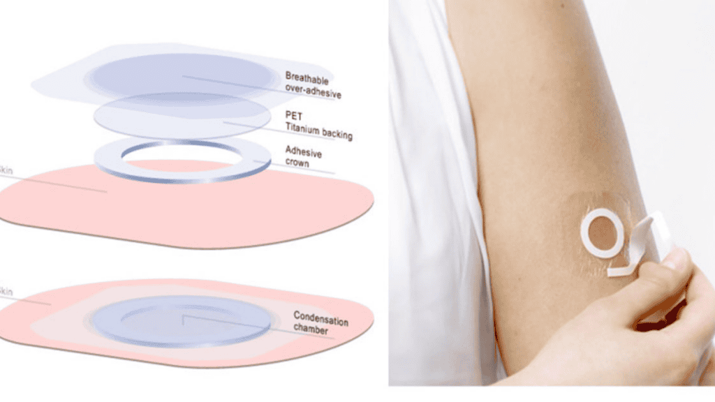 Epicutaneous Immunotherapy 